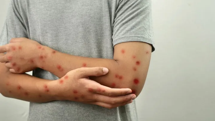 Bị Covid Có Uống Trà Sữa Được Không? Lời Khuyên Từ Chuyên Gia Dinh Dưỡng