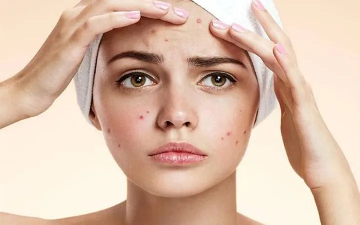 13 Tác Hại Của Trà Sữa Đối Với Sức Khỏe Cần Biết Và Cách Hạn Chế